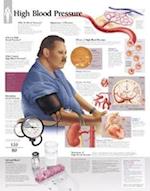 High Blood Pressure Chart