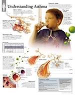 Understanding Asthma Chart