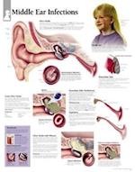 Middle Ear Infection Chart