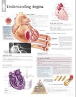 Understanding Angina Chart