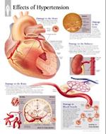 Effects of Hypertension Chart