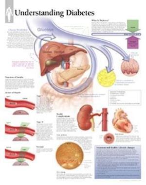 Understanding Diabetes Chart