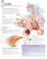 Copd Chart