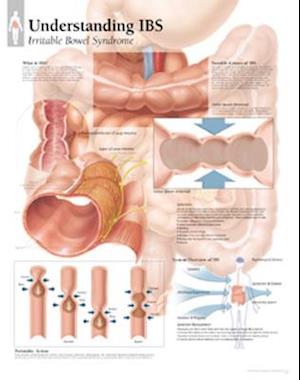 Understanding Ibs Chart