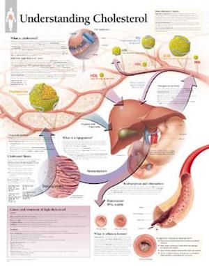 Understanding Cholesterol Chart