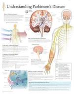 Understanding Parkinson's Chart