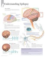 Understanding Epilepsy Chart