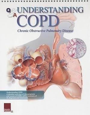 Publishing, S: Understanding COPD Flip Chart