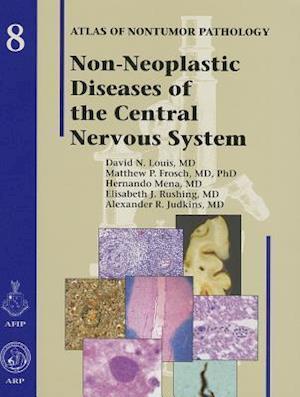 Non-Neoplastic Diseases of the Central Nervous System