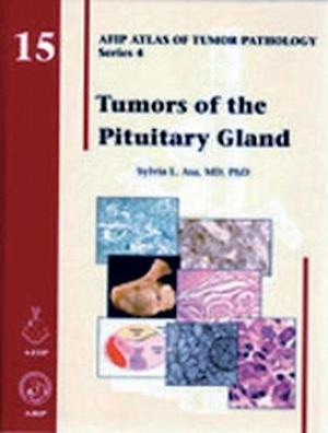 Asa, S:  Tumors of the Pituitary Gland