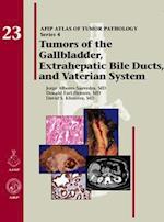 Tumors of the Gallbladder, Extrahepatic Bile Ducts, and Vaterian System