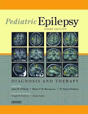 Pediatric Epilepsy