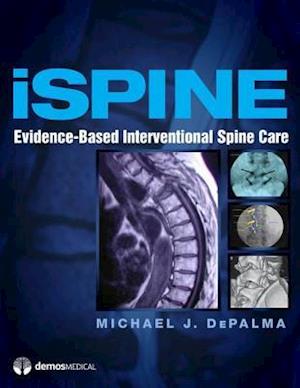 iSpine