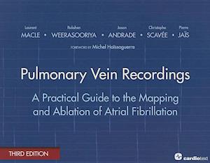 Pulmonary Vein Recordings