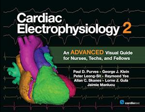 Cardiac Electrophysiology 2: An Advanced Visual Guide for Nurses, Techs, and Fellows