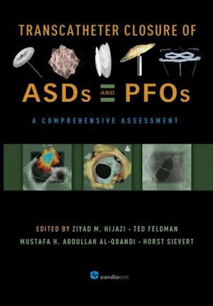 Transcatheter Closure of ASDs and PFOs : A Comprehensive Assessment