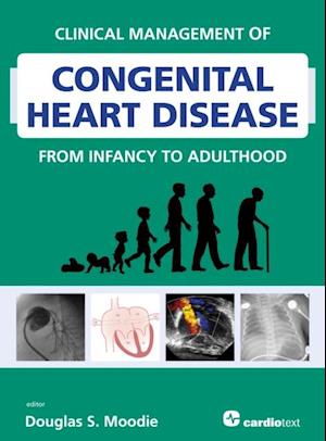 Clinical Management of Congenital Heart Disease from Infancy to Adulthood