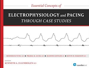 Essential Concepts of Electrophysiology and Pacing through Case Studies