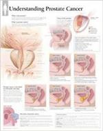 Understanding Prostate Cancer Wall Chart
