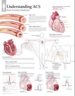 Understanding Acs Wall Chart