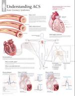 Understanding Acs Wall Chart