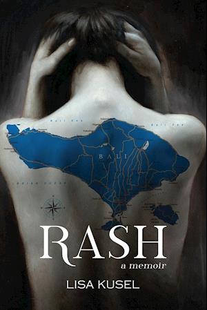 Rash