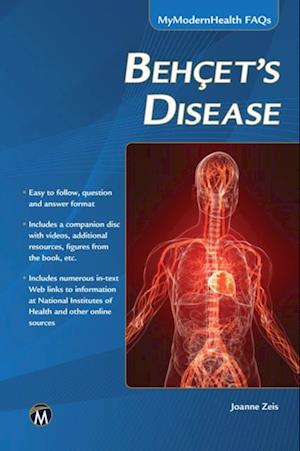 Behcet’s Disease