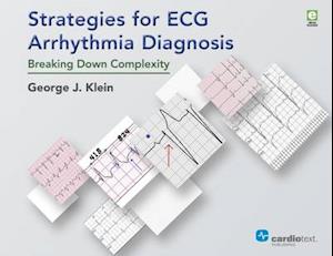 Strategies for ECG Arrhythmia Diagnosis