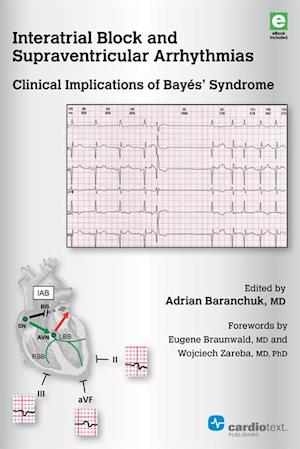 Interatrial Block and Supraventricular Arrhythmias: Clinical Implications of Bayés Syndrome