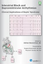 Interatrial Block and Supraventricular Arrhythmias: Clinical Implications of Bayés Syndrome