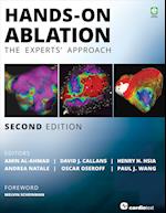 Hands-On Ablation