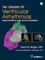 Origins of Ventricular Arrhythmias