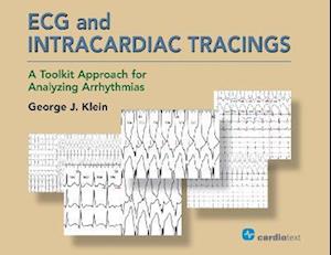 ECG and Intracardiac Tracings