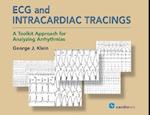 ECG and Intracardiac Tracings