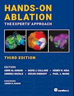 Hands-On Ablation: The Experts' Approach, Third Edition