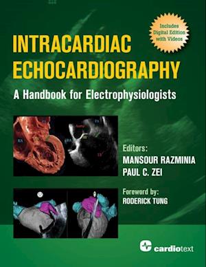 Intracardiac Echocardiography: A Handbook for Electrophysiologists