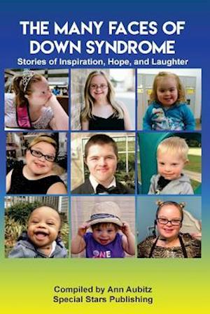 The Many Faces of Down Syndrome