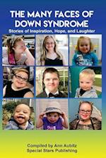 The Many Faces of Down Syndrome