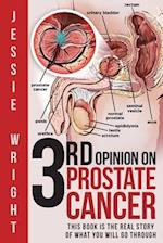 3rd Opinion on Prostate Cancer 