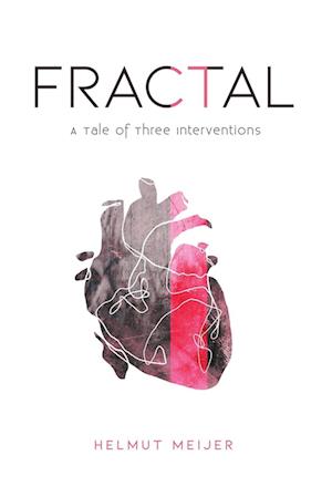 Fractal: A Tale of Three Interventions