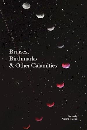 Bruises, Birthmarks & Other Calamities