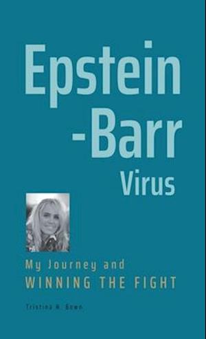 Epstein-Barr Virus