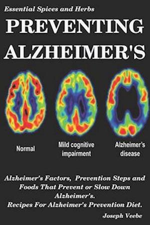 PREVENTING ALZHEIMER'S: Alzheimer's Factors, Prevention Steps and Foods That Prevent or Slow Alzheimer's, Recipes for Alzheimer's Prevention Diet