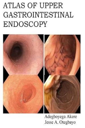 Atlas of Upper Gastrointestinal Endoscopy