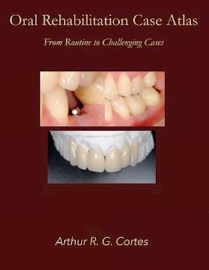 Oral Rehabilitation Case Atlas