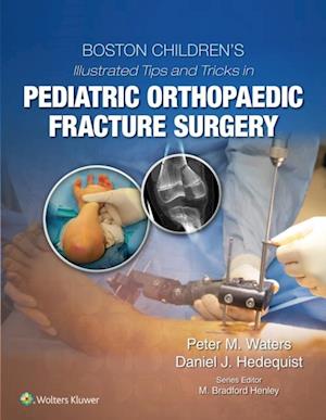 Boston Children's Illustrated Tips and Tricks in Pediatric Orthopaedic Fracture Surgery