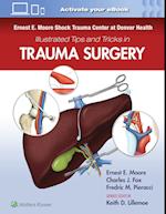 Ernest E. Moore Shock Trauma Center at Denver Health Illustrated Tips and Tricks in Trauma Surgery