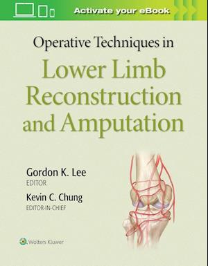 Operative Techniques in Lower Limb  Reconstruction and Amputation