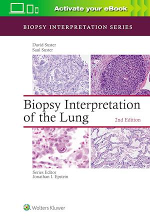 Biopsy Interpretation of the Lung