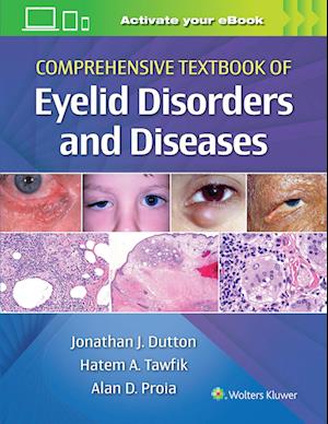 Comprehensive Textbook of Eyelid Disorders and Diseases